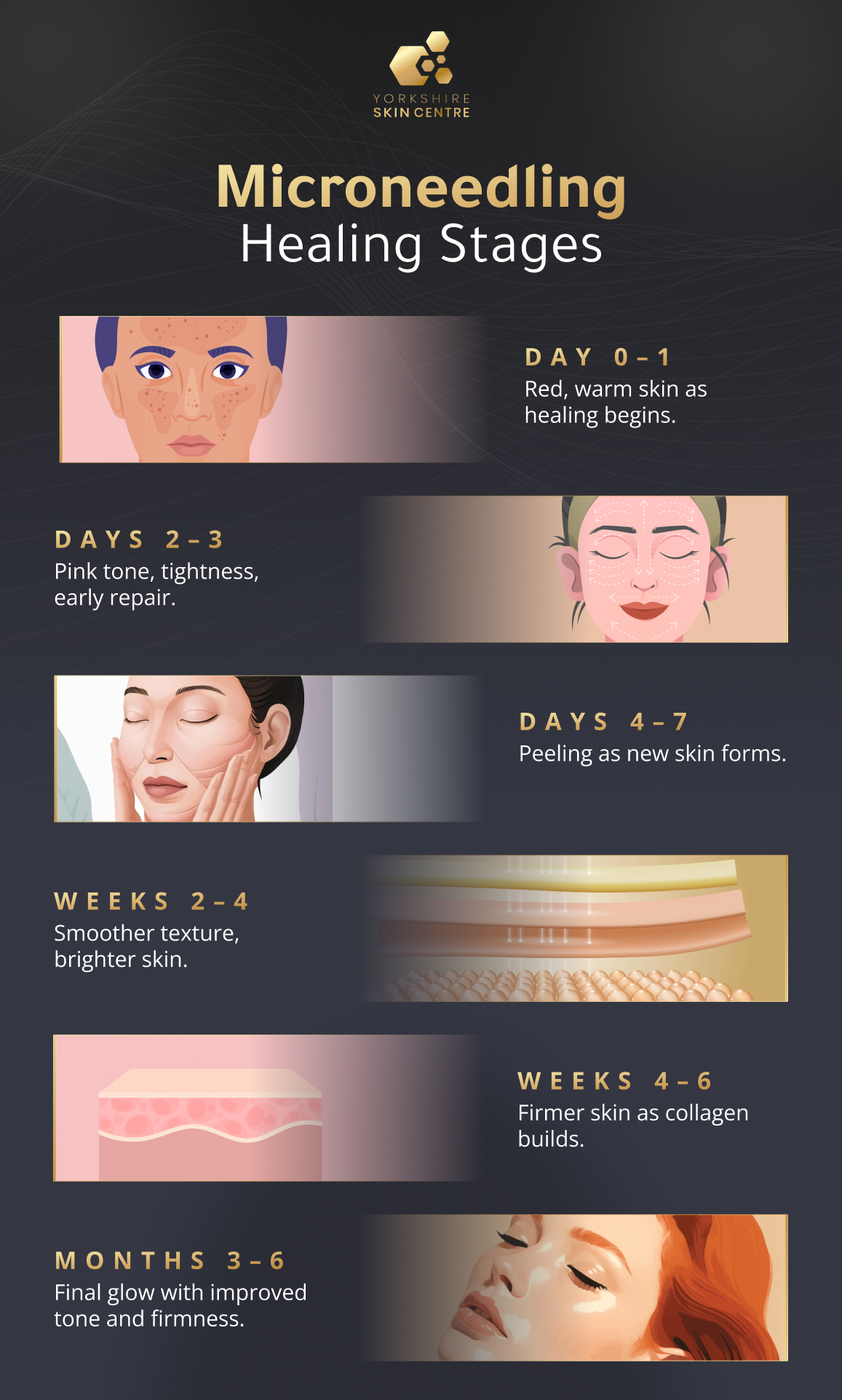 Microneedling healing stages showing day-wise recovery timeline from redness and inflammation to collagen formation and final skin glow.